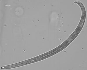 Die neue Nematodenart Prionchulu sturhani