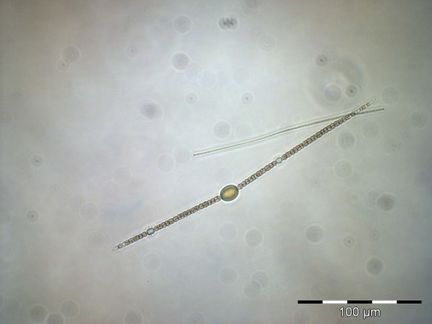 Anabaena bergii